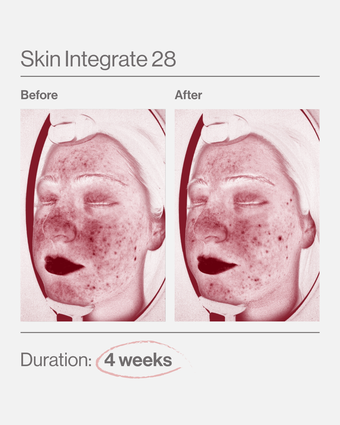Skin Integrate 28 Biome Powder Vorher-Nachher 
